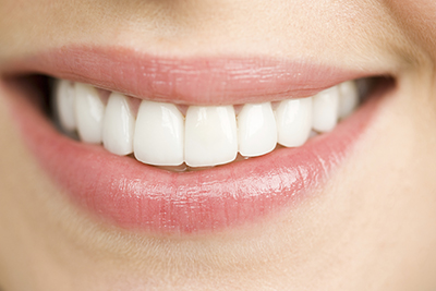 Close up of a woman smiling at her dentist office.