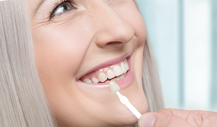 Image of a dental professional placing a veneer in a patient's mouth, at Greashaber Dentistry in Ann Arbor, MI.